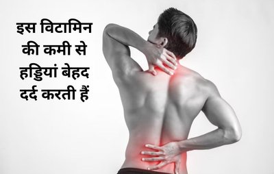 बॉडी में विटामिन डी का 12 ng/ml से कम होना सेहत के लिए हो सकता है घातक