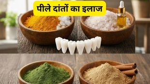 Home and Natural Remedies for Toothache Pain | Yellow teeth bad breath and gum bleeding | how to stop tooth pain fast