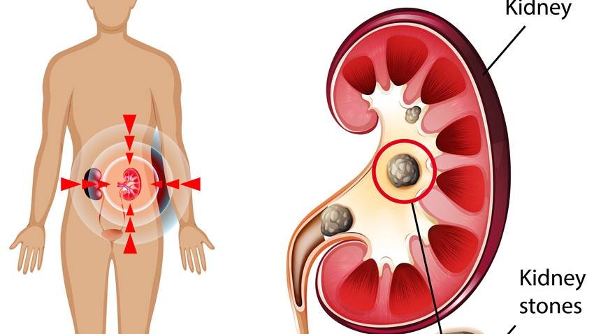 yoga poses for healthy kidneys