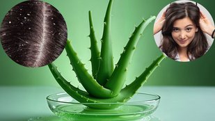 Aloe Vera for Dandruff | Itchy Scalp | How to use aloe vera for itchy scalp
