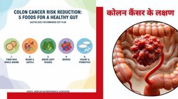 Colon Cancer Diet: कैंसर फ्री रहेगी आंत! रोज़ खाएं ये 5 चीजें और दूर भगाएं कोलन कैंसर का खतरा, मशहूर गैस्ट्रोलॉजिस्ट की खास सलाह
