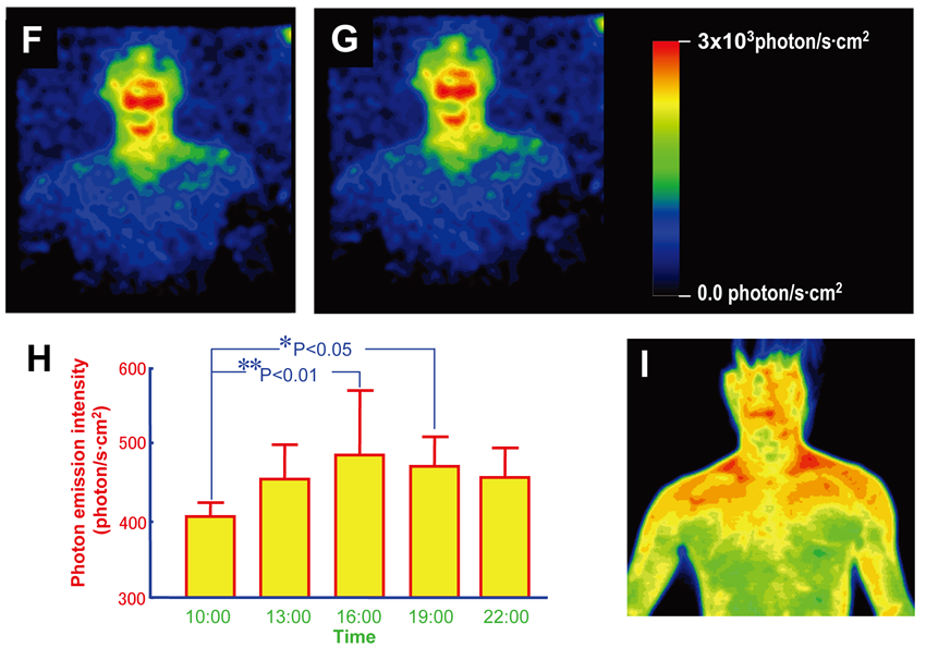 Human bioluminescence