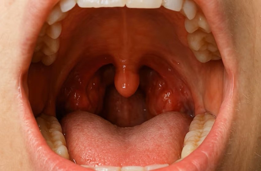 Uvula