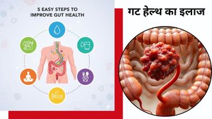 Signs of poor gut health, How to improve gut microbiome, Gut health and mental health link, गट हेल्थ सुधारने के तरीके, Symptoms of leaky gut,