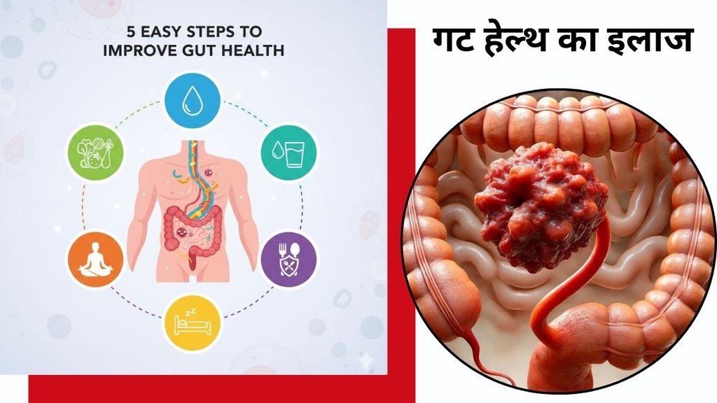 Signs of poor gut health, How to improve gut microbiome, Gut health and mental health link, गट हेल्थ सुधारने के तरीके, Symptoms of leaky gut,