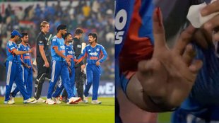 IND vs NZ 1st T20, Axar Patel Injury, Axar Patel Injured Nagpur T20
