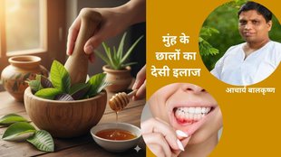 Mouth ulcer home remedy, Acharya Balkrishna tips for stomach ulcer, Guava leaves benefits for mouth ulcer, मुंह के छालों का घरेलू उपाय,Mouth ulcer home remedy