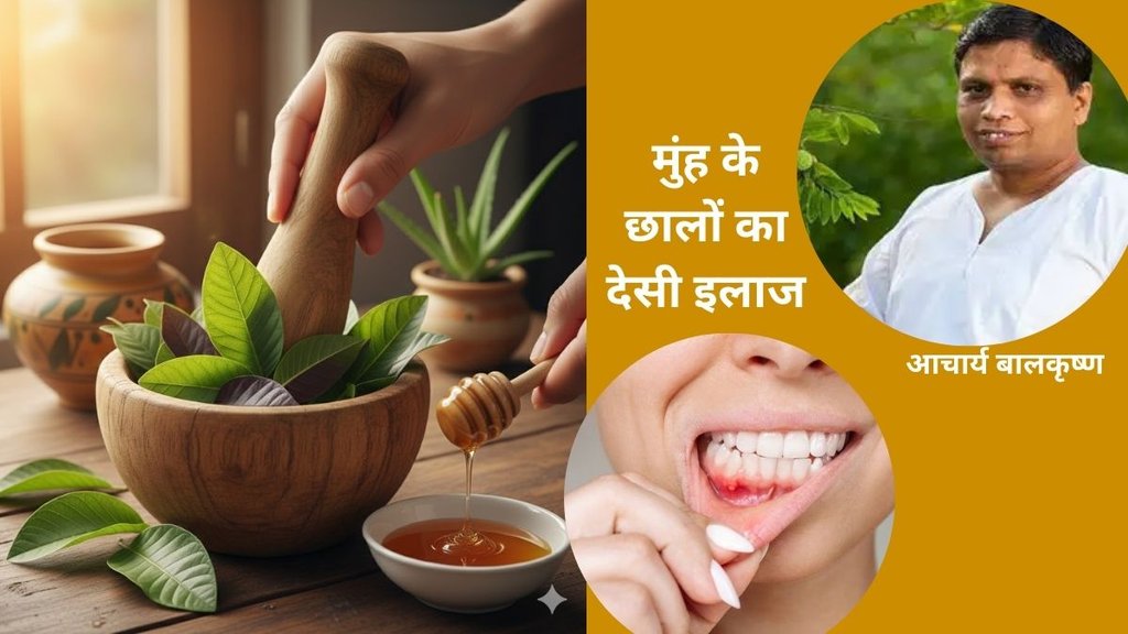 Mouth ulcer home remedy, Acharya Balkrishna tips for stomach ulcer, Guava leaves benefits for mouth ulcer, मुंह के छालों का घरेलू उपाय,Mouth ulcer home remedy