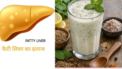 Fatty Liver में फायदेमंद हो सकता है छाछ, Buttermilk लिवर को कैसे करता है डिटॉक्स