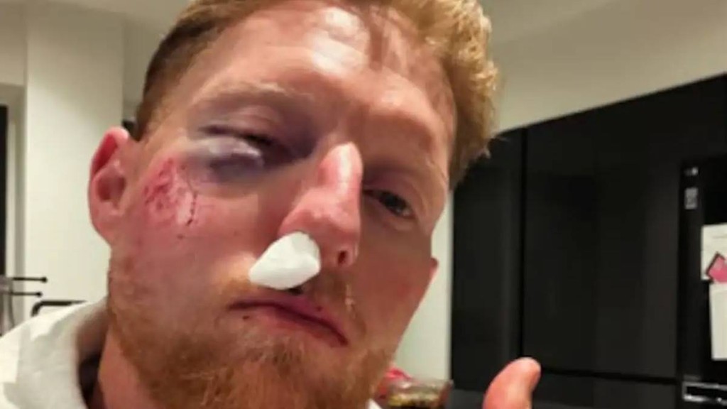 Ben Stokes, England Test captain Ben Stokes, Ben Stokes injury