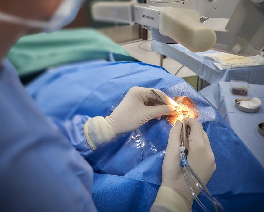 Cataract Surgery