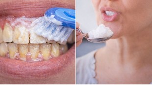 Natural Teeth Whitening, Toothache Remedies, Hansaji Yogendra Health Tips, Dental Care Ayurveda,दांतों का पीलापन, दांत दर्द के घरेलू उपाय, हंसाजी योगेंद्र के टिप्स, दांतों की सफाई, प्राकृतिक दंत चिकित्सा,