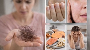 Nuts & Seeds that are good for healthy hair, Biotin Rich Foods,Omega-3 fatty acids,Egg Yolks, Vitamin B7,Biotin-Rich Foods For Hair