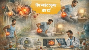 Hip Joint Tumor Symptoms, Bone Cancer in Hip, Causes of Hip Tumor , Hip Pain vs Tumor,Hip Joint Tumor, Bone Cancer in Hip Symptoms,