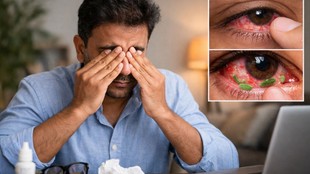Rubbing eyes, Eye rubbing effects, Why rubbing eyes feels good, Eye health, Digital eye strain, Eye pressure, Eye irritation