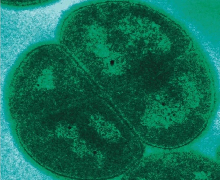 Deinococcus radiodurans