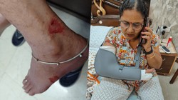 संपादकीय: 14,230 डॉग बाइट केस, पर मुआवजे के लिए सिर्फ 9 आवेदन; पंचकूला में जागरूकता की कमी उजागर