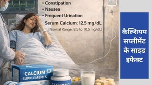calcium supplement side effects, hypercalcemia symptoms, Dr. Tickoo Max Healthcare, high calcium blood levels, kidney damage from supplements, Vitamin D and calcium interaction