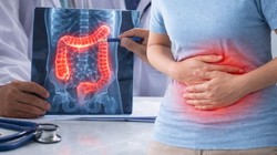 Piles vs IBD: कहीं आप बवासीर समझकर IBD को तो नहीं कर रहे नजरअंदाज? जानें पेट की इस गंभीर बीमारी के लक्षण और बचाव