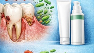 Periodontitis, Gum Disease, Oral Microbiome, Gingivitis, Porphyromonas gingivalis, Targeted Antibacterial Therapy, Microbiome-friendly Toothpaste,