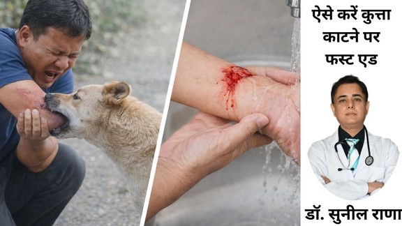 Rabies Vaccine Schedule,रेबीज इंजेक्शन का समय, Dog Bite First Aid, कुत्ता काटने पर प्राथमिक उपचार, Anti Rabies Vaccine Price, रेबीज के इंजेक्शन की कीमत