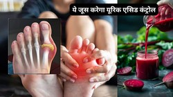 Uric Acid Control: यूरिक एसिड बढ़ने से हो सकता है गाउट का खतरा, जानिए दर्द कम करने में कैसे मदद कर सकता है चुकंदर का जूस
