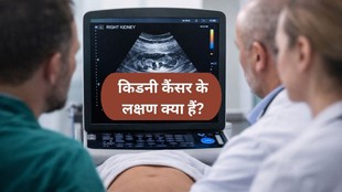 Kidney cancer symptoms, kidney health after 40, early signs of kidney cancer, kidney cancer prevention tips, kidney cancer risk factors