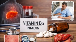 Vitamin B3 side effects, Niacin overdose symptoms, Niacin benefits and risks, Vitamin B3 for longevity truth, Niacin liver damage, High dose niacin dangers, NAD+ and aging,