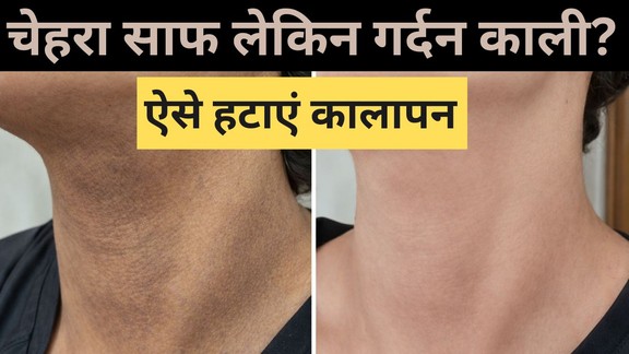 Gardan ko gora kaise kare | dark-neck-tanning-home-remedies | kali gardan saaf karne ka tarika
