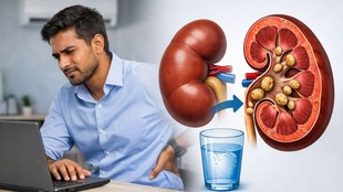 kidney stones in young adults, chronic dehydration symptoms, high sodium diet risks, flank pain and vomiting, prevent kidney stones naturally
