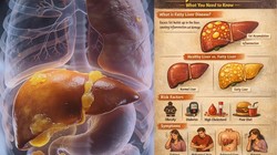 ग्रेड 3 फैटी लिवर को 34 साल के पुरुष ने किया रिवर्स, डॉक्टर ने बताया डाइट चार्ट, जानिए कैसे डाइट ने दिखाया असर