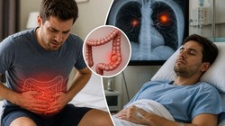 Health Alert: क्या मामूली कब्ज हो सकता है कोलन कैंसर का संकेत? 29 साल के युवक के केस से समझें सारी कहानी