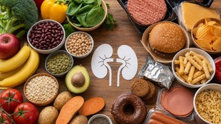 kidney diet mistakes, chronic kidney disease diet, kidney health, nephrologist advice, potassium foods, high protein diet risks, plant based diet kidney health, kidney friendly foods