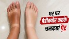 ghar-par-pedicure-kaise-kare | feet-tanning-and-dead-skin-removal-tips