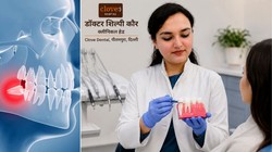 Wisdom Teeth: अक्ल दाढ़ निकालनी चाहिए या रहने दें? डेंटिस्ट से जानें
