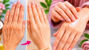 Hathon-ki-jhurriyan | hand-wrinkles-remedies
