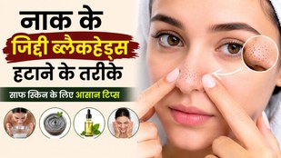 blackheads-hatane-ke-aasan-tips | pores-ki-gandagi-kaise-saaf-karen | nose-blackheads-removal-tips