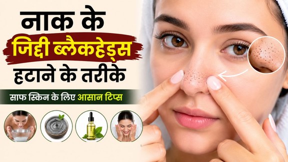 blackheads-hatane-ke-aasan-tips | pores-ki-gandagi-kaise-saaf-karen | nose-blackheads-removal-tips
