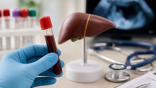 ALT levels, liver health, Alanine Aminotransferase, fatty liver disease, liver damage signs, liver function test, Ministry of Health, liver enzyme, high ALT, liver stress, fatty liver symptoms,