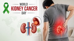 World Kidney Cancer Day: किडनी कैंसर के क्यों बढ़ रहे हैं मामले, यूरो-ऑन्कोलॉजिस्ट से जानिए लक्षणों की पहचान कैसे करें और बचाव भी