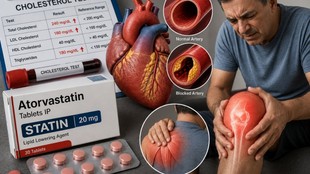 Statins, Cholesterol Medicine, Muscle Pain, Statin Side Effects, SAMS, LDL Cholesterol, Heart Disease, Cardiovascular Disease, Ryanodine Receptor, Calcium Leak,