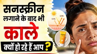 sunscreen-lagane-ke-baad-bhi-tanning-kyon-hoti-hai | why-skin-tans-even-after-using-sunscreen