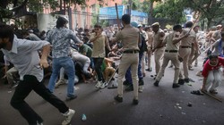 सीजेपी के संसद चलो प्रदर्शन के दौरान घायल हुई 21 साल की लड़की वेंटिलेटर पर, शेख इरशाद की आंख में लगी गोली