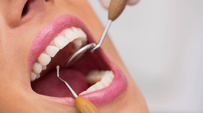 Everyday Habits that Damage Teeth