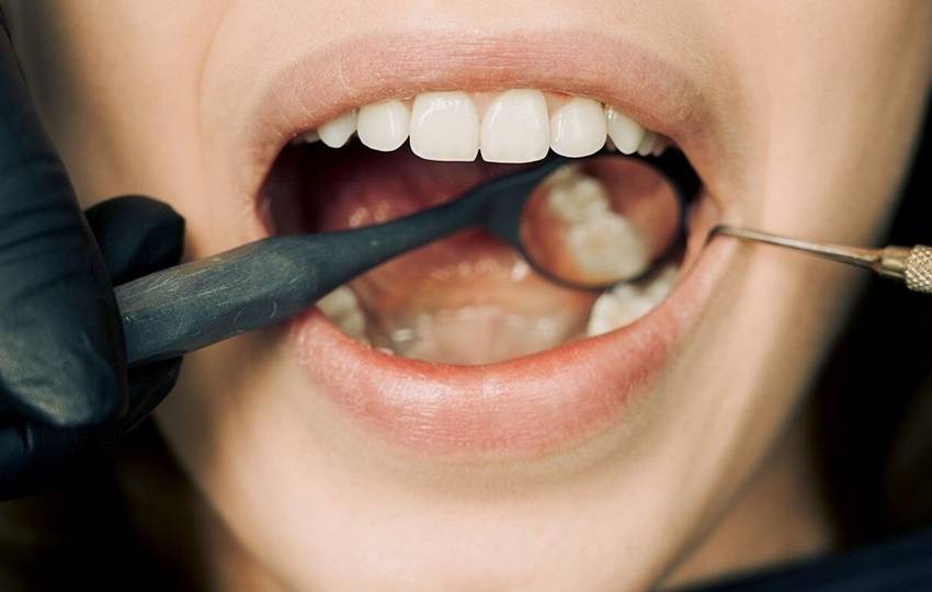 habits that weaken teeth