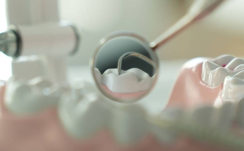 bad habits for teeth