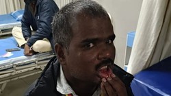 बेंगलुरु: SIR के दौरान सरकारी अधिकारी पर हमला, दो गिरफ्तार
