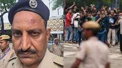 CJP Protest: ‘मेरे सिर पर पत्थर लगा, खून बह रहा था’; घायल हुए एसीपी ने बताई पूरी कहानी