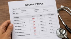 कोलेस्ट्रॉल और ट्राईग्लिसराइड कंट्रोल करने में मदद करेगा लहसुन, दालचीनी और मेथी का पानी, एक्सपर्ट से जानिए फायदे और तरीका