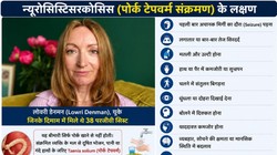 Medical Case Study: महिला के शरीर से निकला 1 मीटर का टेपवार्म, क्या ये शरीर में गांठें बना सकता है? डॉक्टरों से जानिए इसके लक्षण और बचाव के तरीके